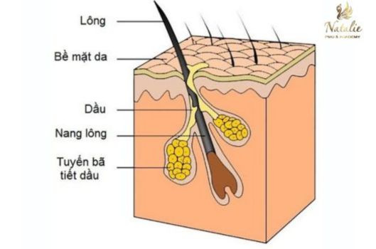 moi-bi-noi-mun-trang-sau-phun-xam (3)